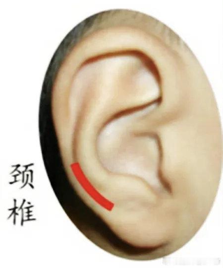 耳穴颈椎主治落枕，颈椎病，颈肩酸痛，颈椎骨质增生或退化，颈扭伤及各种原因引起的颈