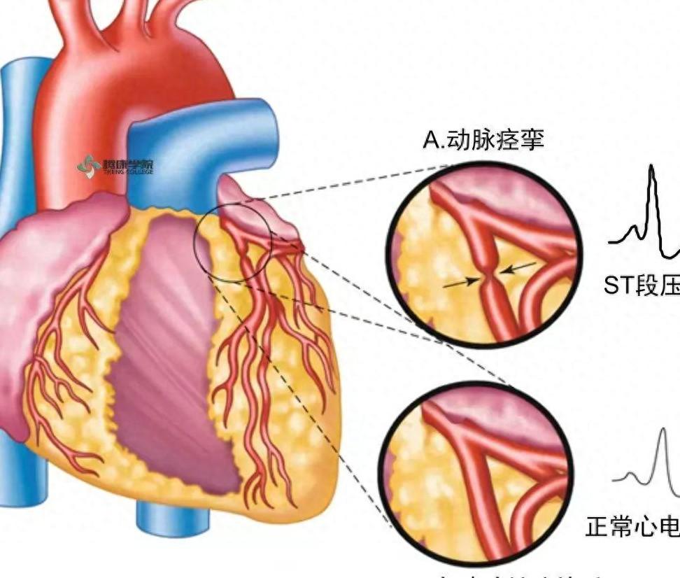 这2药合用，活血通络，或成防治冠心病和中风的“黄金搭档”心脑血管的问题，一直