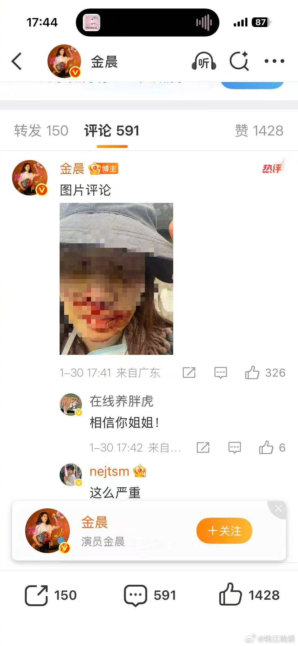 #警方通报金晨事件#【#金晨发布车祸伤情照片金晨被曝肇事逃逸被撞墙农户已获赔#