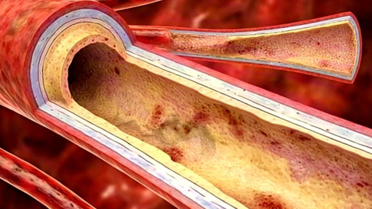 腿凉是穿少了？医生提醒：持续这个温度，下肢动脉硬化已形成 有的人一到秋冬，就