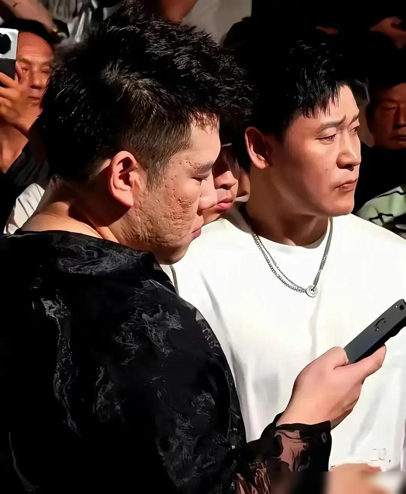 有人怼木森直播间的20元洗面奶了。说他把这货吹得比大牌还牛，可自己脸上痘坑都