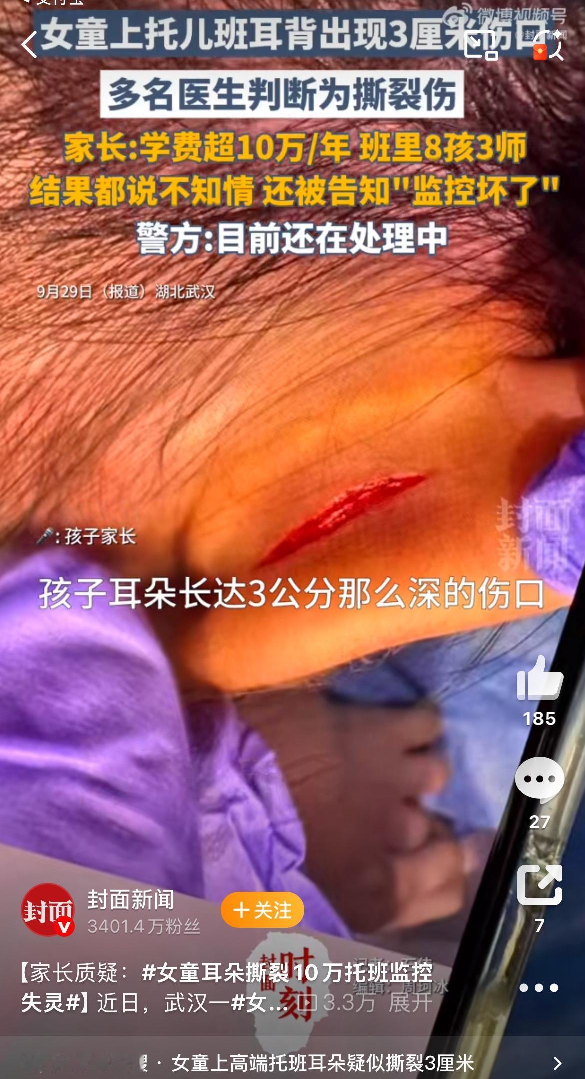 花十万块送娃上高端托班，最后换来一道三厘米的撕裂伤和一句“监控坏了”，这事儿换谁