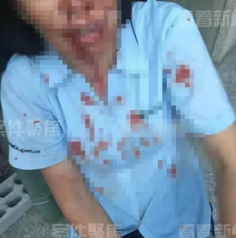 上海，一外甥带5人上门，对舅舅进行围殴，舅妈激愤之下，拿起一瓶强腐蚀性液体，直接