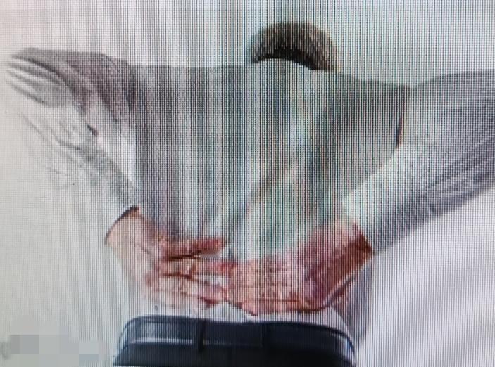 在家治疗腰间盘突出两周真可能有奇迹。之前我腰4/5膨出、腰5骶1突出，疼得腰直不