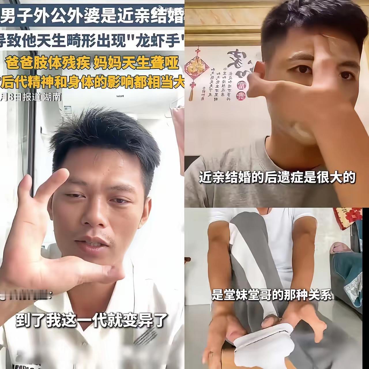 真是丧心病狂，都这样了还要结婚生子！​湖南一90后男子因外公外婆近亲结婚，导致