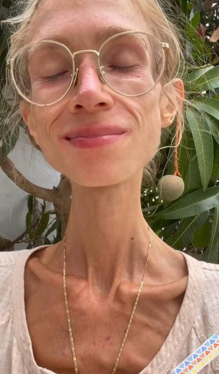 看看长期只吃水果的素食者会出现什么后果？波兰的一个女子从高中开始坚持吃素食，拒绝