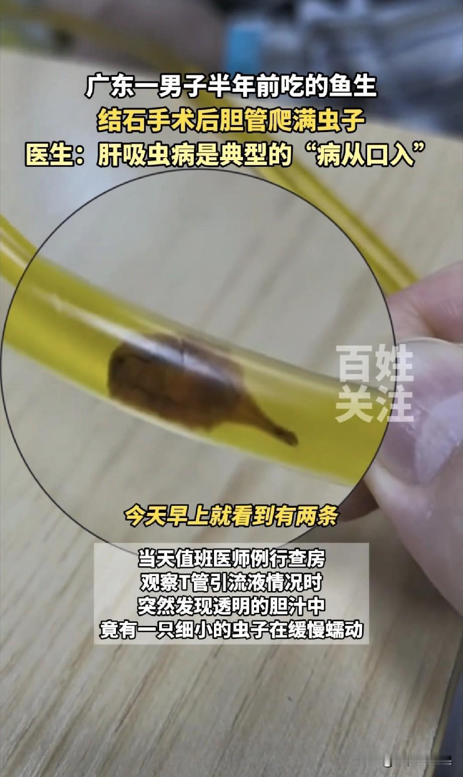 凌晨3点，广东急诊室冲进来一个捂着肚子打滚的男人。“医生快救我！我疼得要晕过去