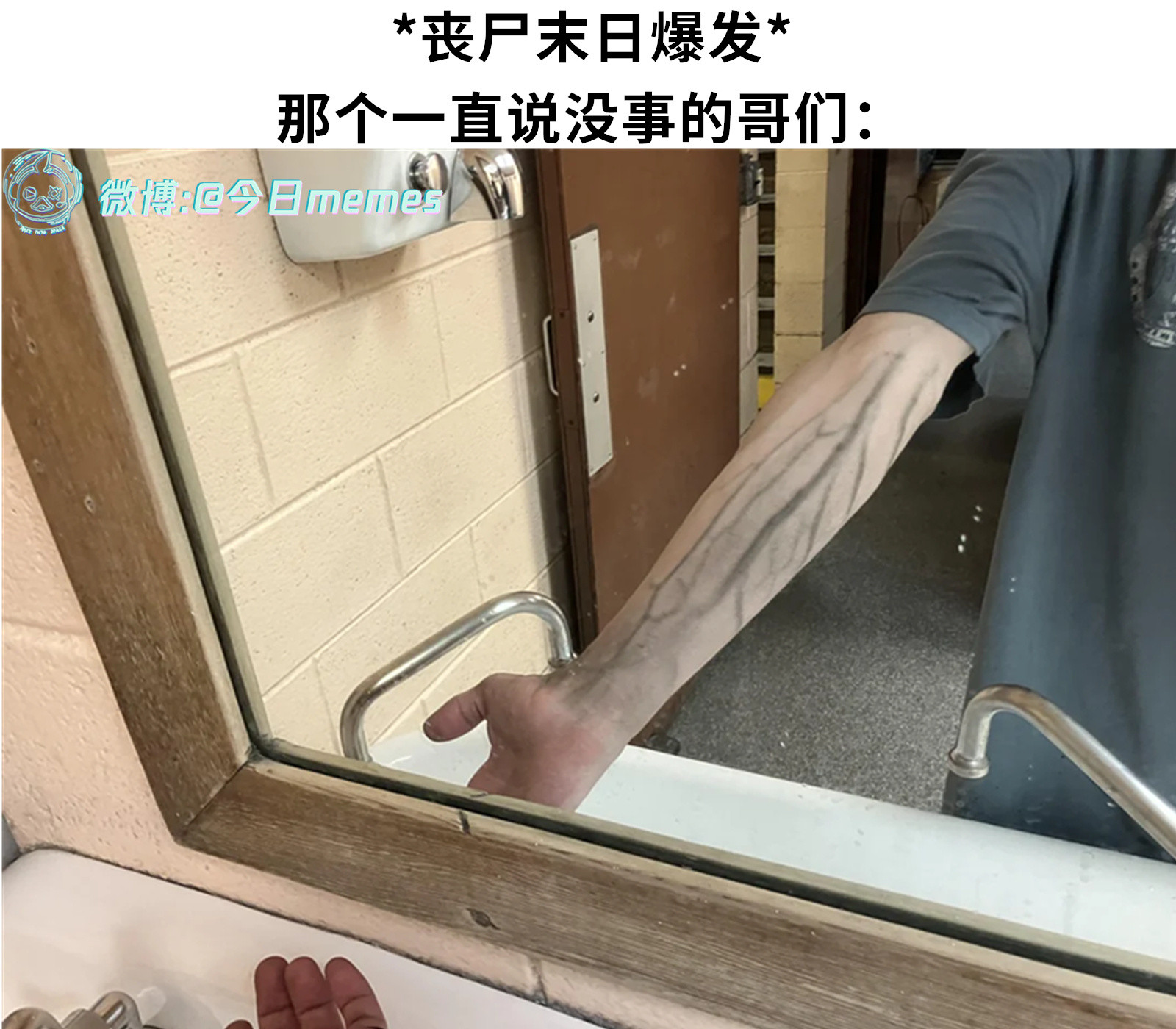 擦伤罢了（9gag）今日meme今日memes​​​