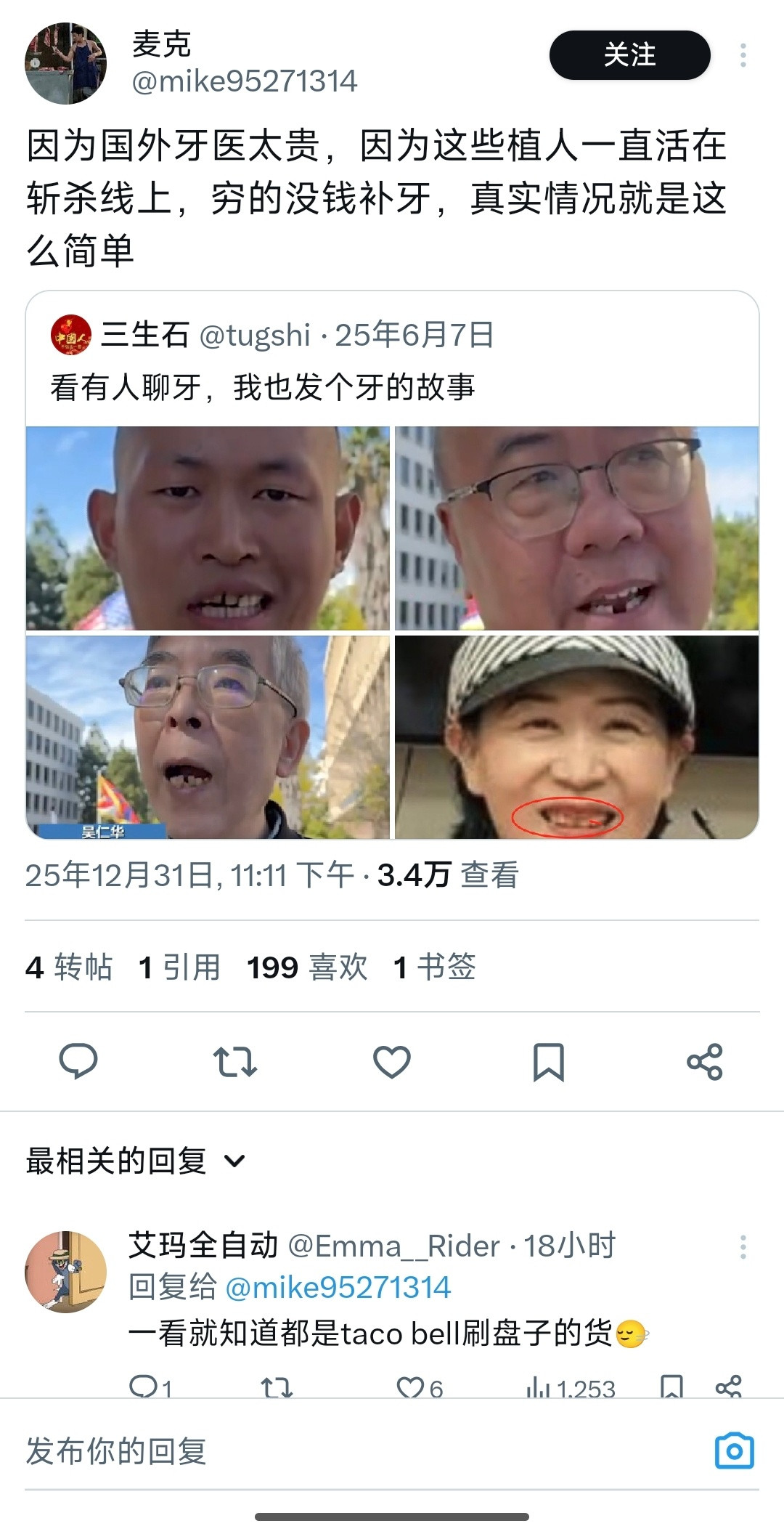 凤姐也缺了好几颗牙