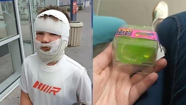 法国玩具烫伤事件太双标！甩锅中国制造，却绝口不提熊孩子作死法国近期闹得沸沸