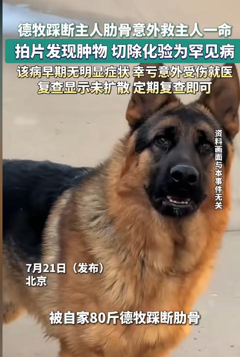 谁能想到，一只80斤重的牧羊犬突然扑向主人，竟把她的肋骨撞断。可到了医院检查才发