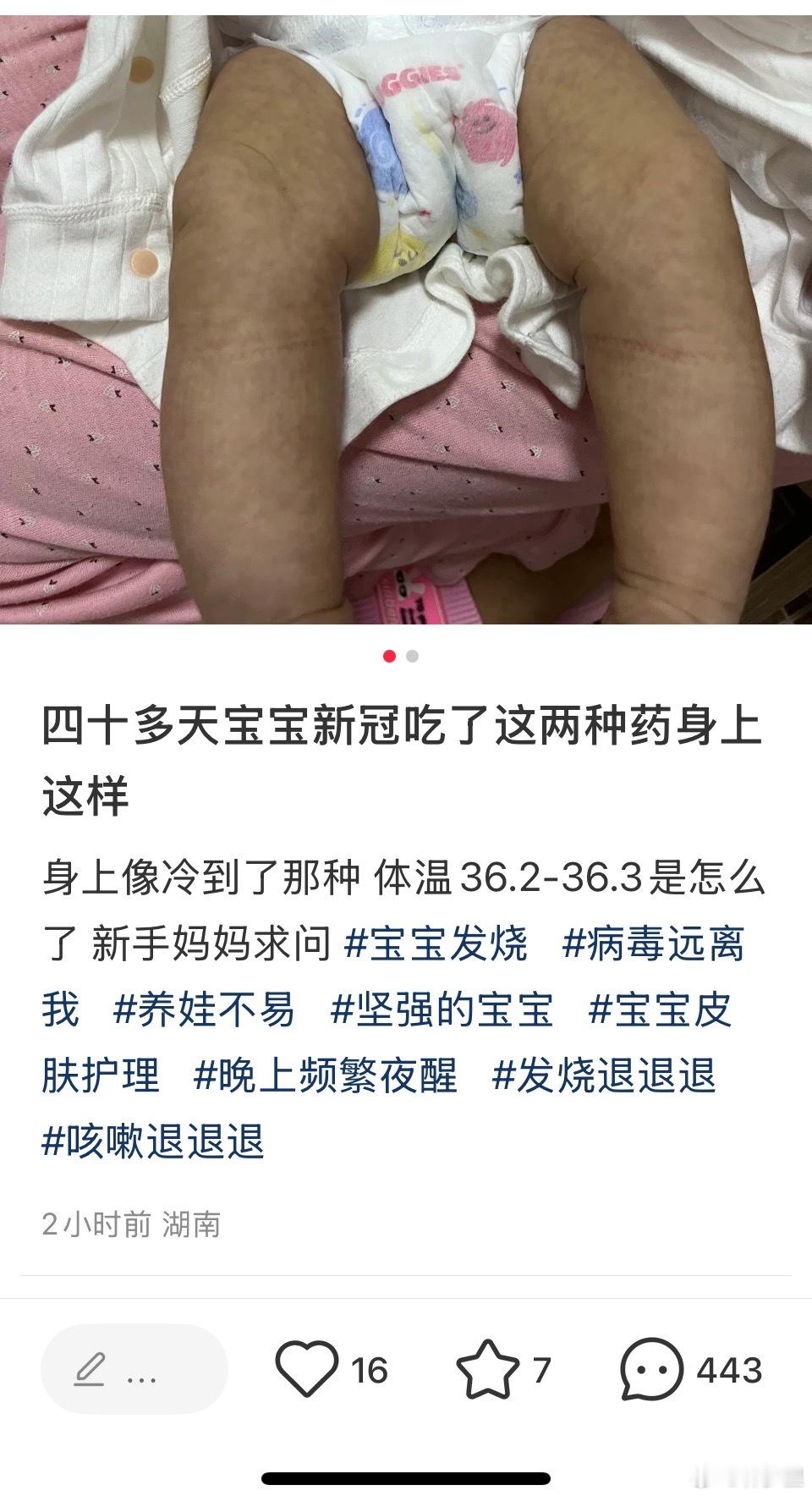 给四十多天新冠感染中的宝宝洗澡…两眼一黑，投胎是个技术活。​​​