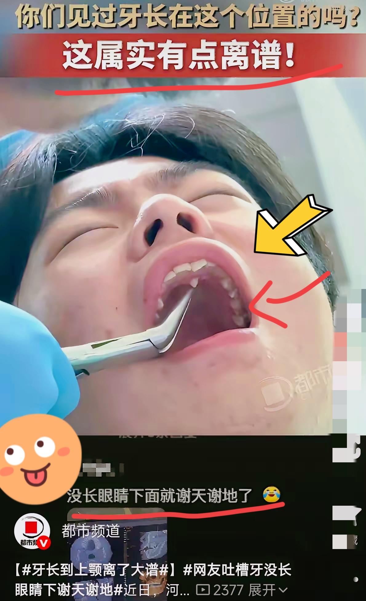 真的大开眼界！河北一名小伙牙疼跑去看牙，谁都没想到会查出这么稀罕的状况！那