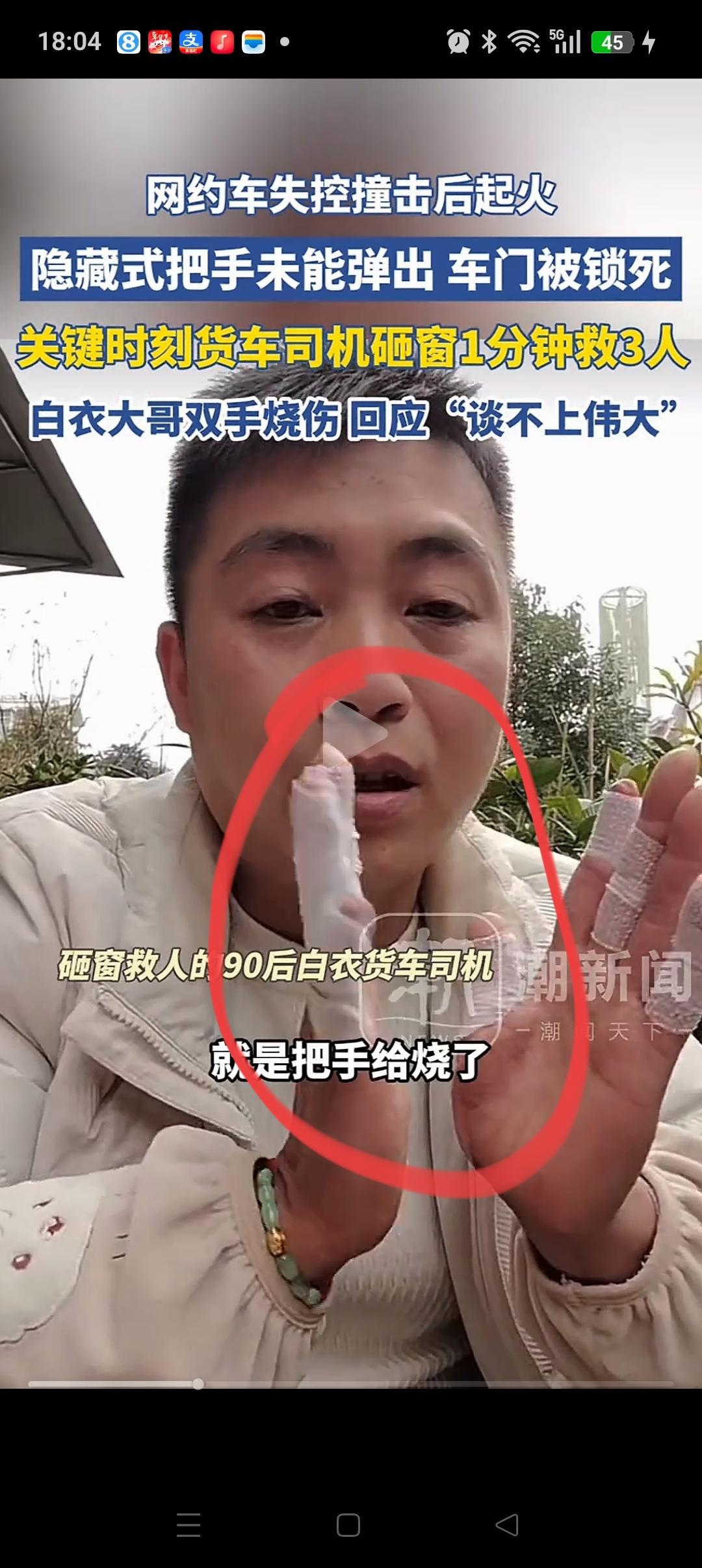 云南一网约车侧滑起火，救人的白衣大哥太伟大了，双手三度烧伤，连10个手指都缠上了