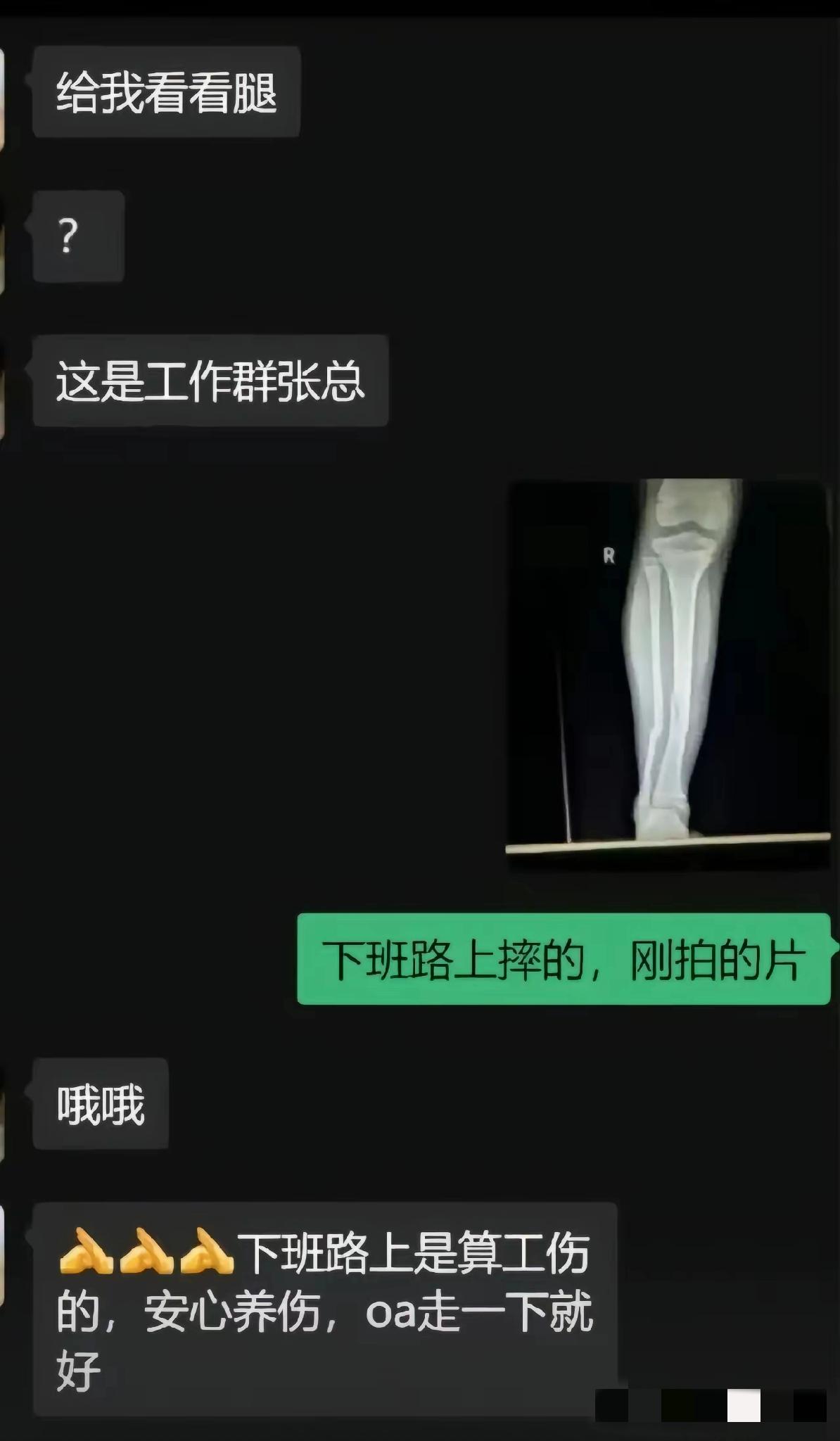 幸亏只是要求看腿。