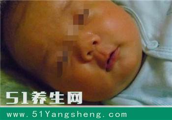 刚出生的宝宝患上脑瘫, 只因孩子出现这种症状, 家人却没有当回事