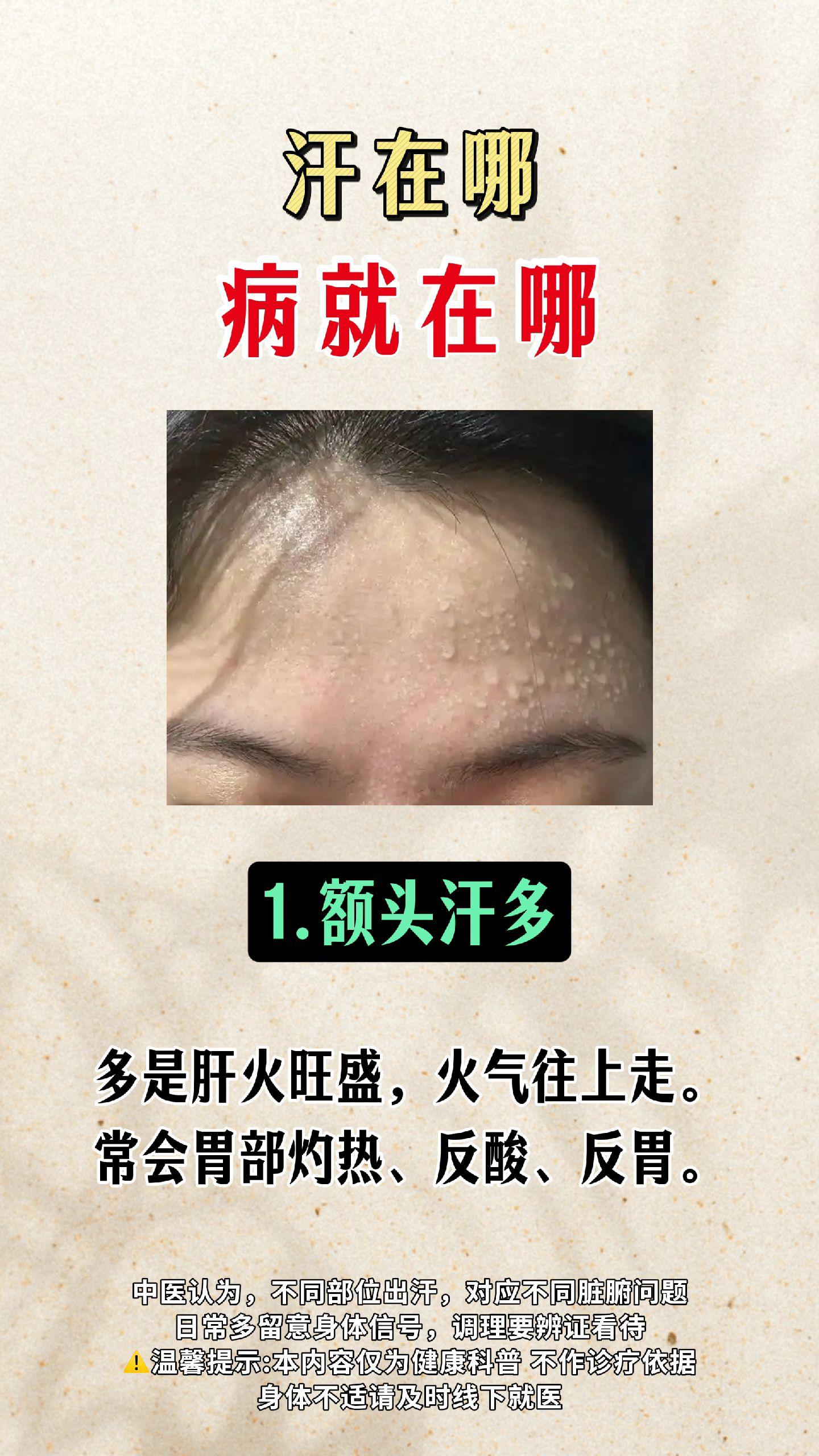 中医 出汗多 中医辨证