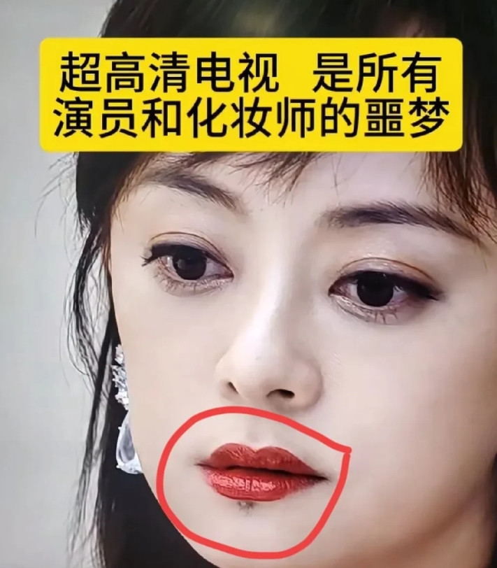 孙俪点痣的原因找到了她的这颗痣已经存在了快20年这颗痣伴随着她大红大紫，现在