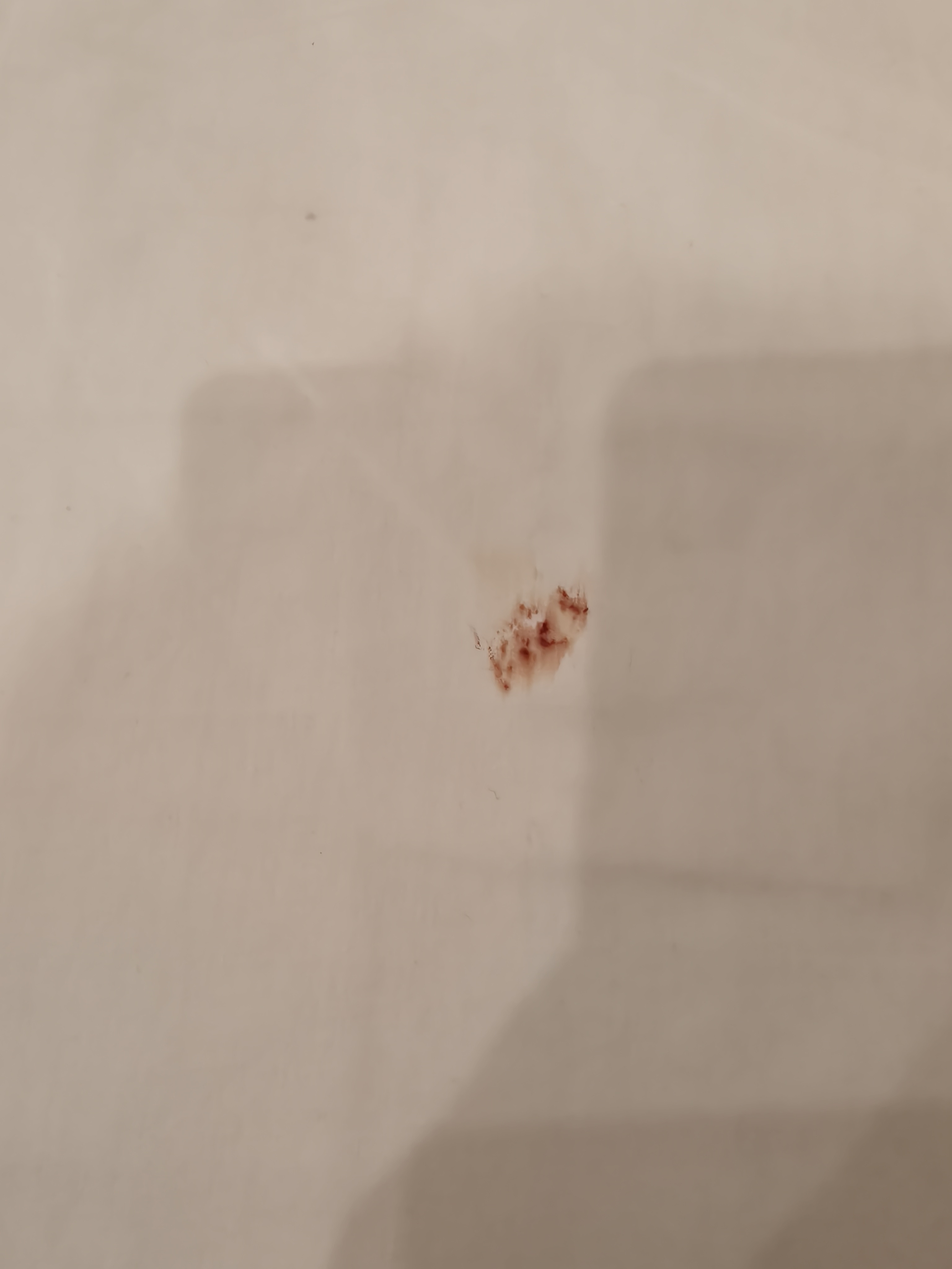服了，我们民宿的布草都是一客一换的，有客人居然说床单上有血渍，说我们没换床单。我