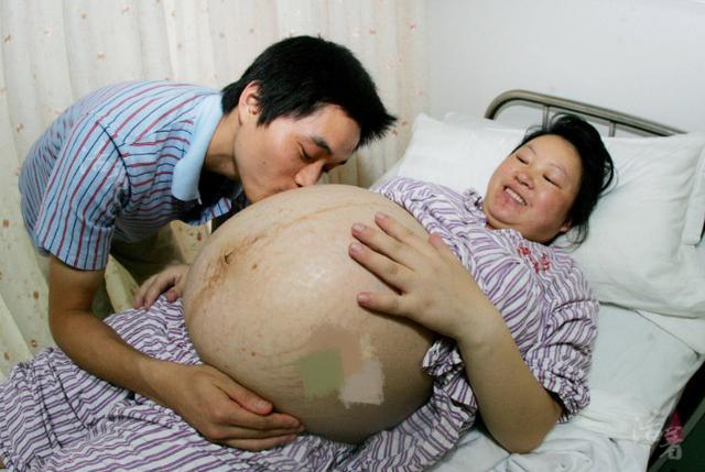 女子怀了四胞胎, 已经有一个大女儿, 看到孩子性别不知该不该高兴