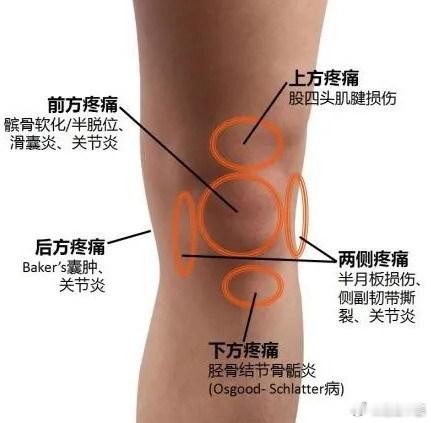 膝盖疼，常见的5个原因；1、膝关节受凉：现如今天气越来越冷，膝盖受凉之后，一方