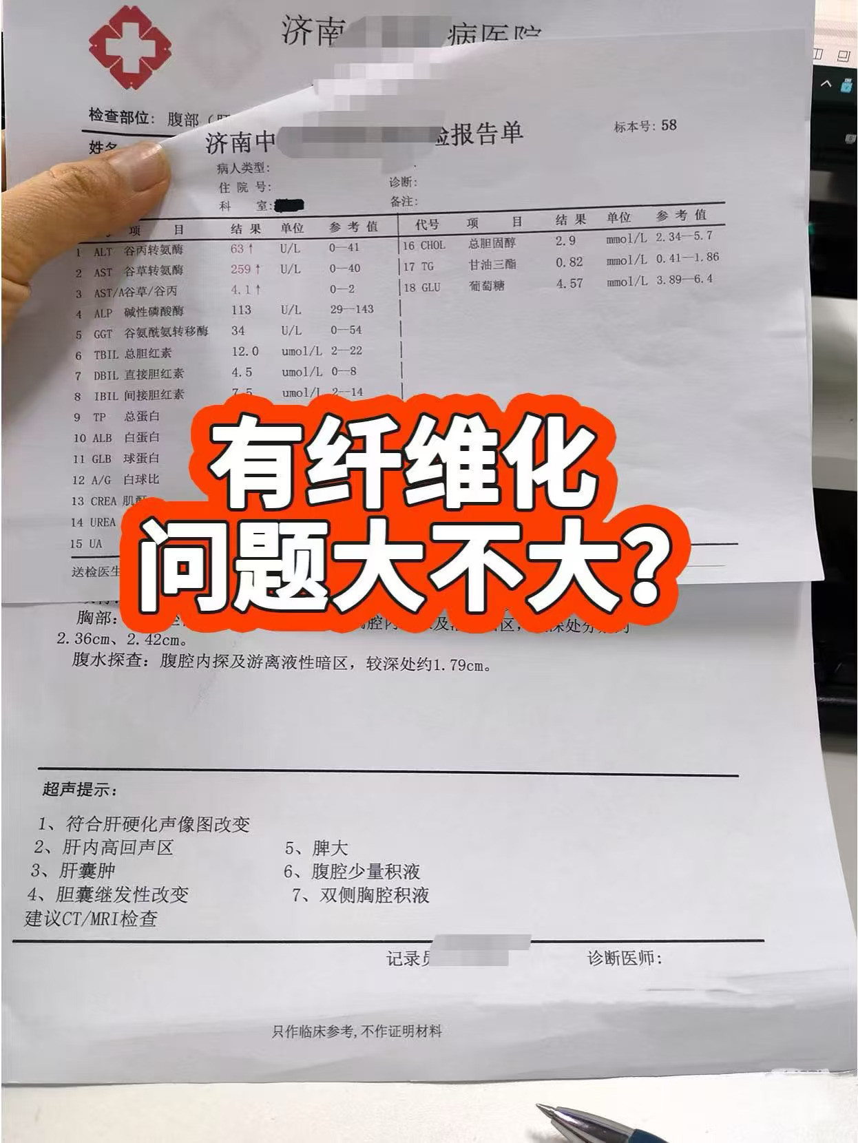 有肝纤维化，问题大不大，肝病朋友要知道！ 前几日接诊的一位山东济南的老...