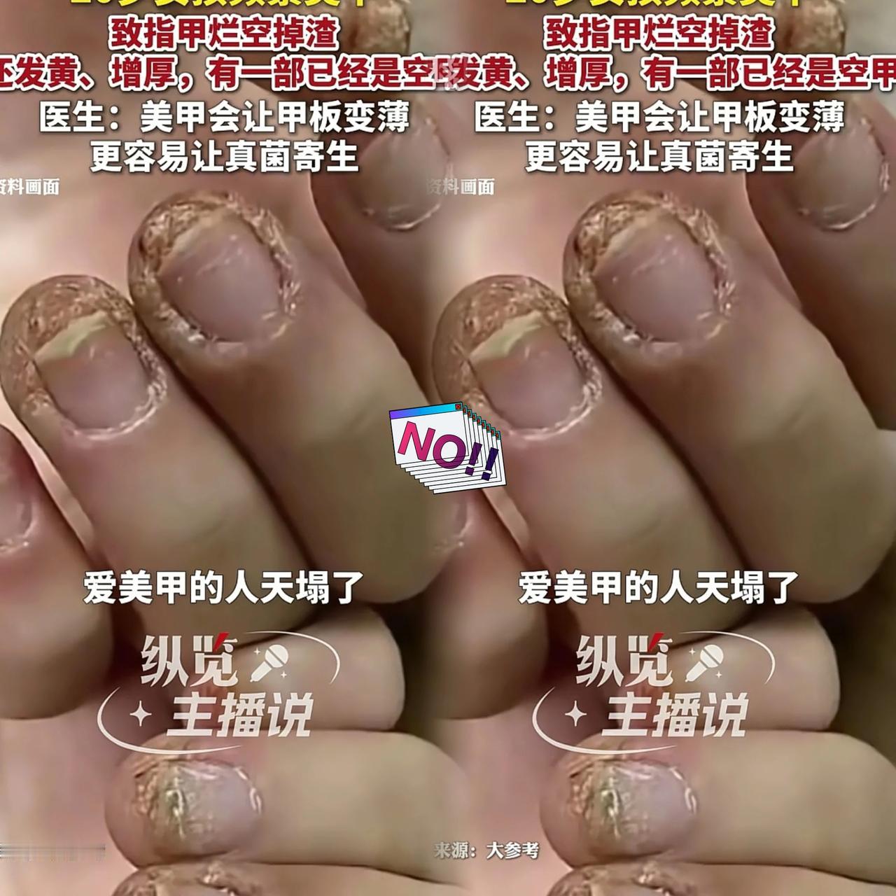 你敢信？这双满是伤痕、空甲掉渣的手，居然是个20岁姑娘的！不是干粗活累的，