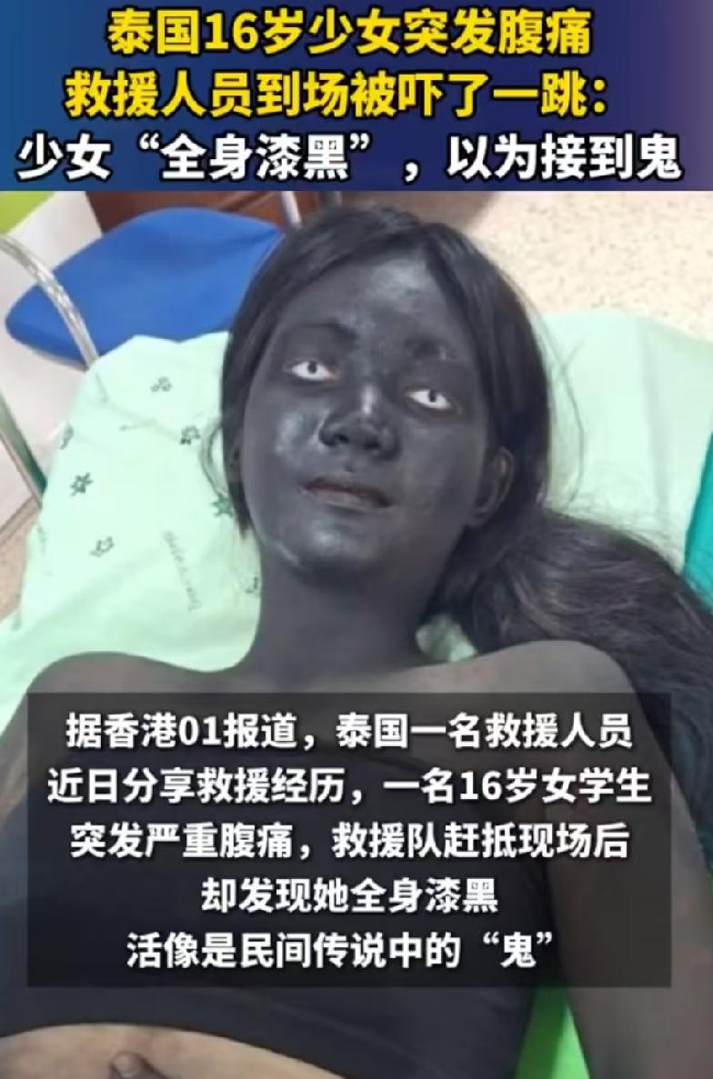 救援人员进门那一刻，整个人都懵了。病床上躺着个“女鬼”，全身漆黑，只剩两个白