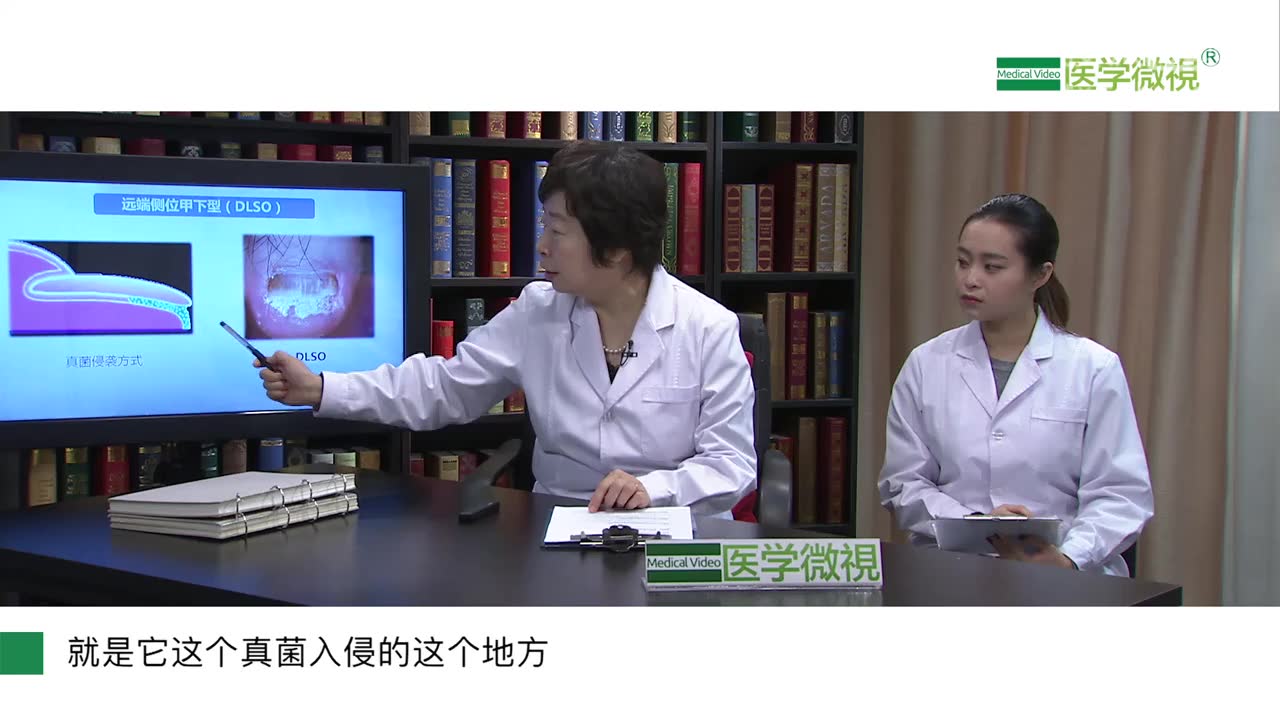 [医学微视]有脚气的人就容易得灰指甲吗?