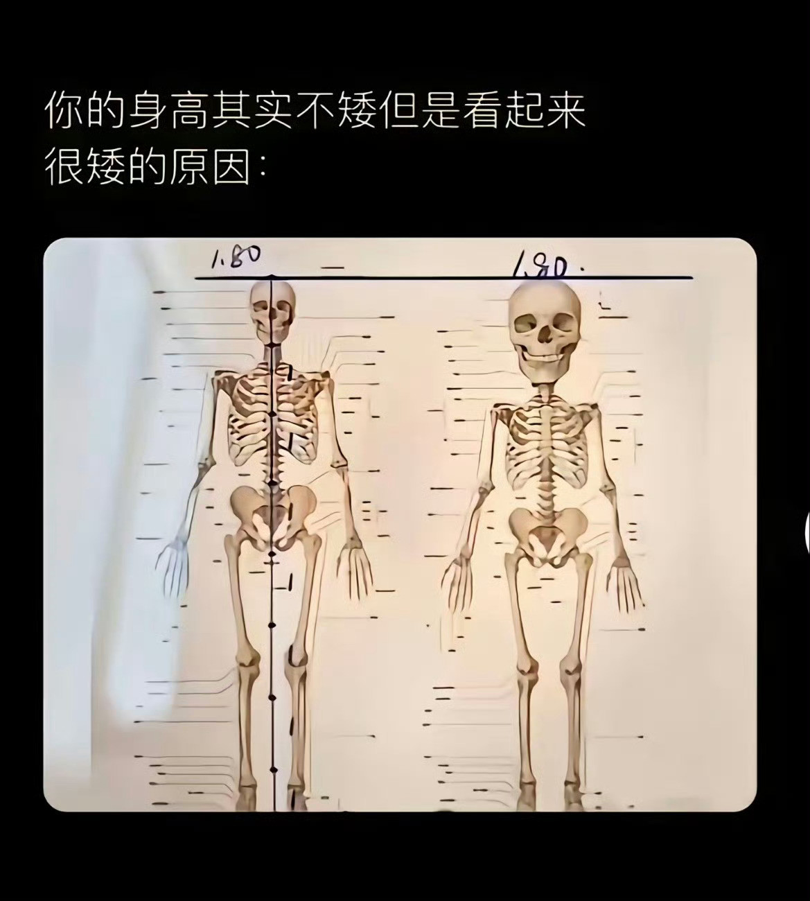 虚假的九头身特点：腿长真实的九头身特点：头小