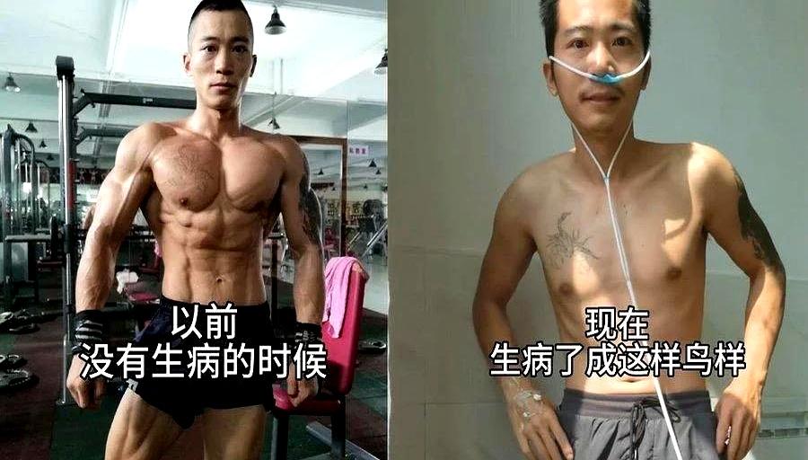 平时天天喊着要马甲线八块腹肌，真进趟医院才知道全是虚的！现在不少人去健身房死磕