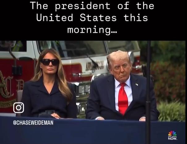 税宗这是肿么啦？脸歪嘴斜，这是中风的症状啊！美国医生都没有想办法给这位美国病人