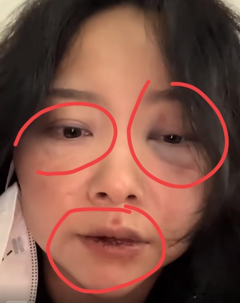 一国女网恋仅半年，还是个菲律宾人，便跑去奔现追求“真爱”，结果毫不意外，对方爱得