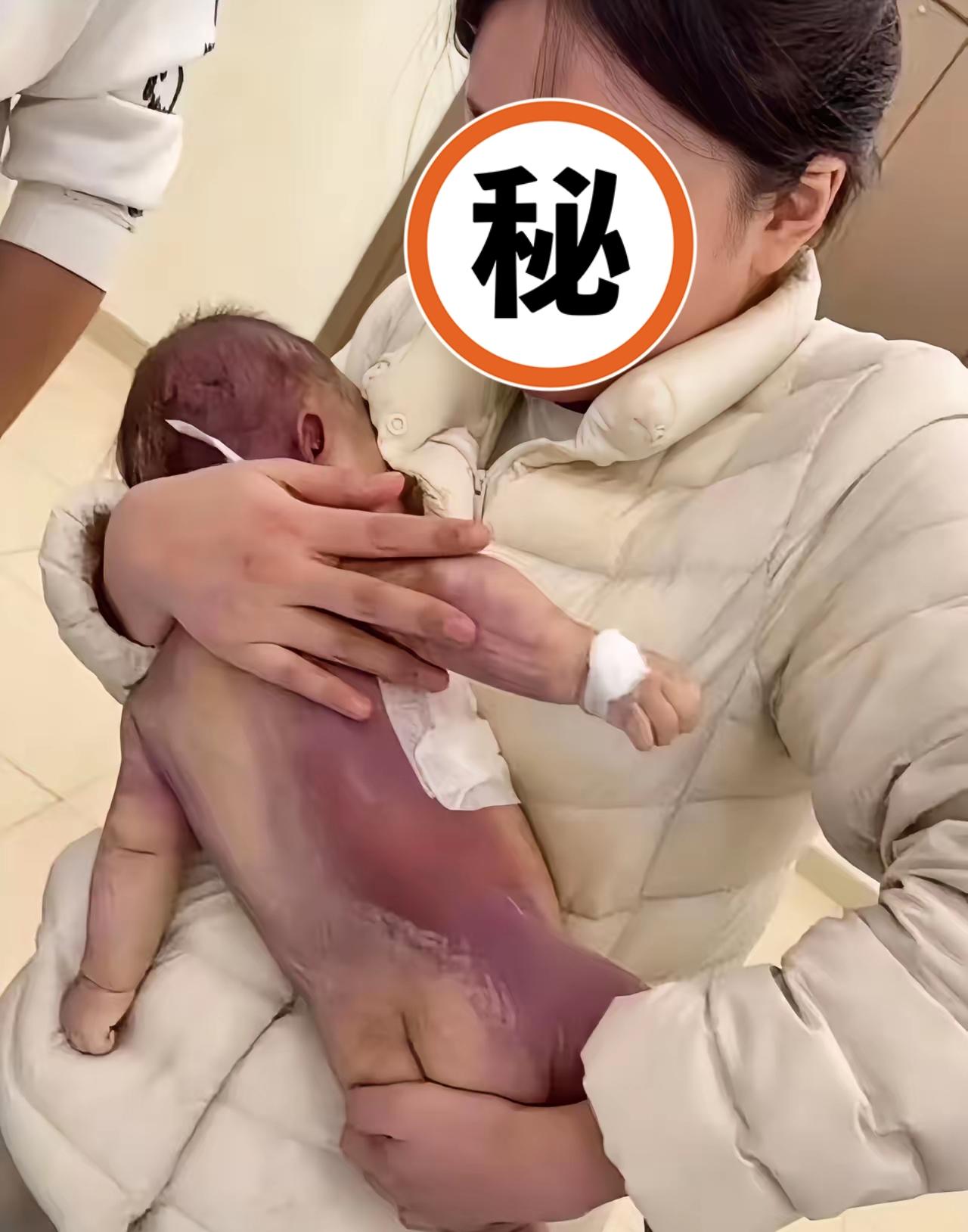 娃卵圆孔未闭做微创手术九个小时没抢救过来好好的孩子没了谁不心疼？难免怀疑是