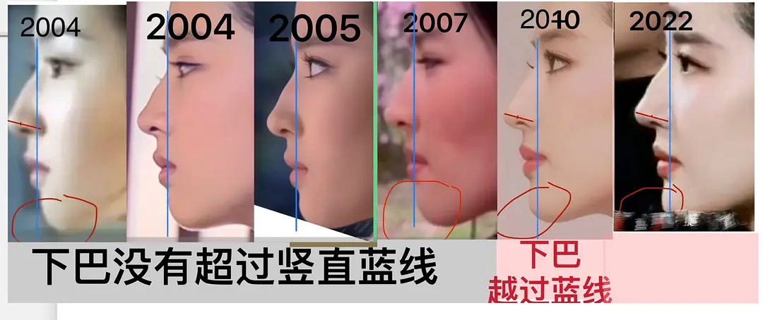 刘亦菲是纯天然美女吗？