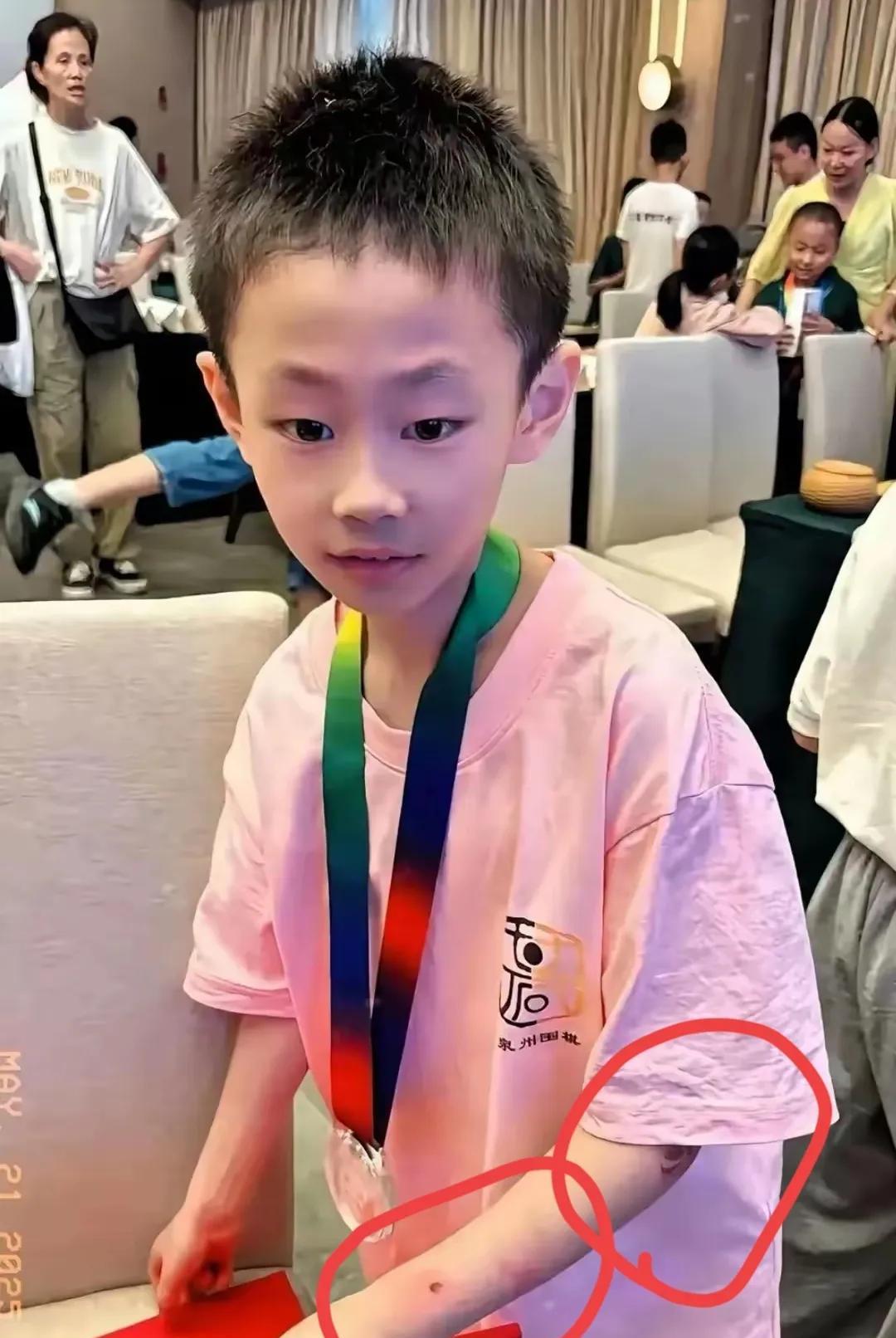 一个围棋天才少年尽管脖子上挂着奖牌，但身上却是伤痕累累，他清瘦的脸庞，迷茫的眼神