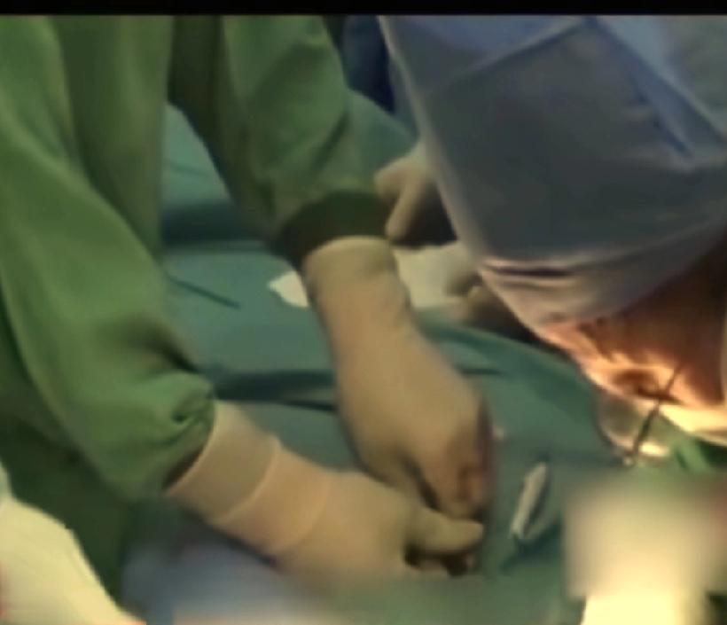 工地惊魂！42岁钢筋工关键部位被切断，妻子一个关键举动保住了整个家的希望。