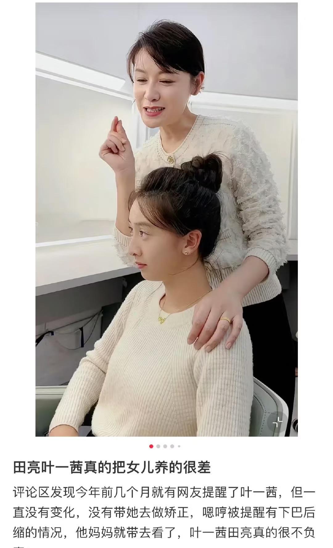这下再也没人说叶一茜把女儿养得很差了，森碟的下巴后缩已经矫正成功！如今才17岁就