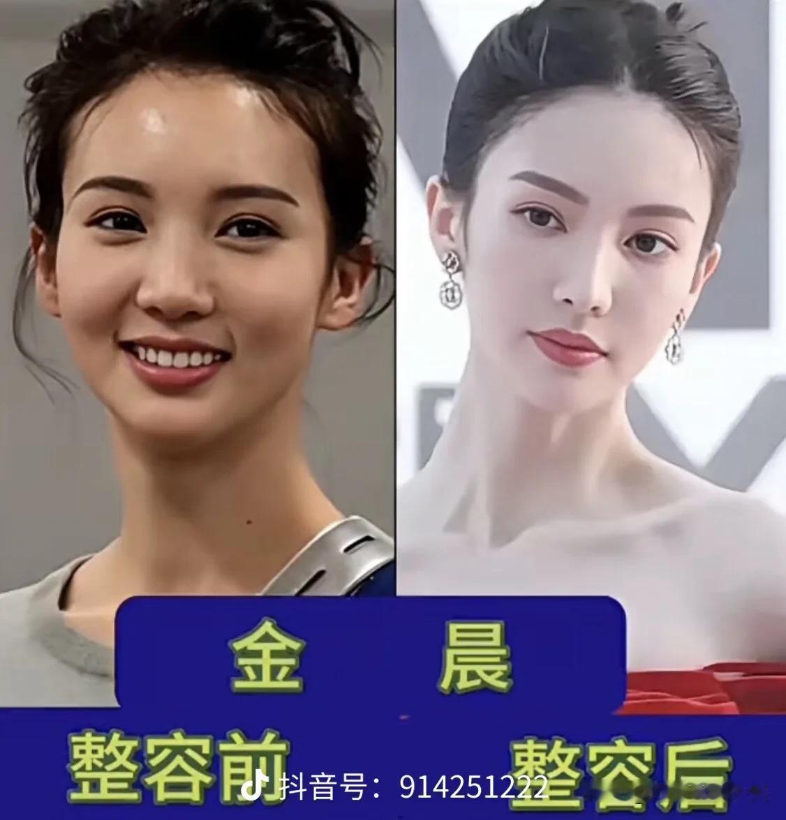 时光重塑颜值，女明星今昔容貌对比翻看女星刚出道青涩旧照，再看如今荧幕模样每个