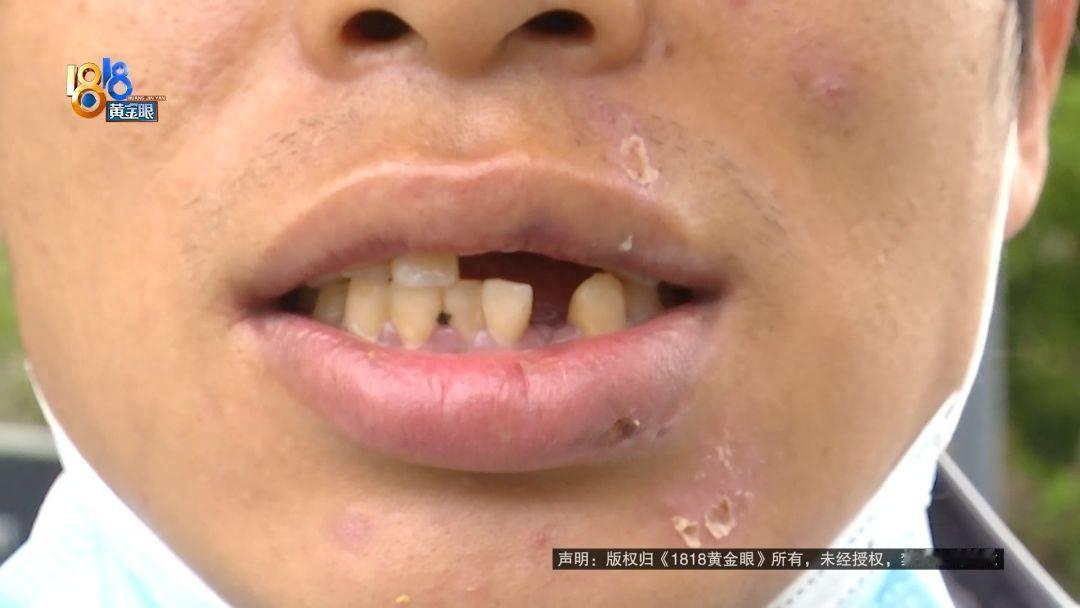 哑巴吃黄连！浙江杭州，一小伙凌晨下雨没带伞，一路小跑经过某商场人行道时，没注意脚