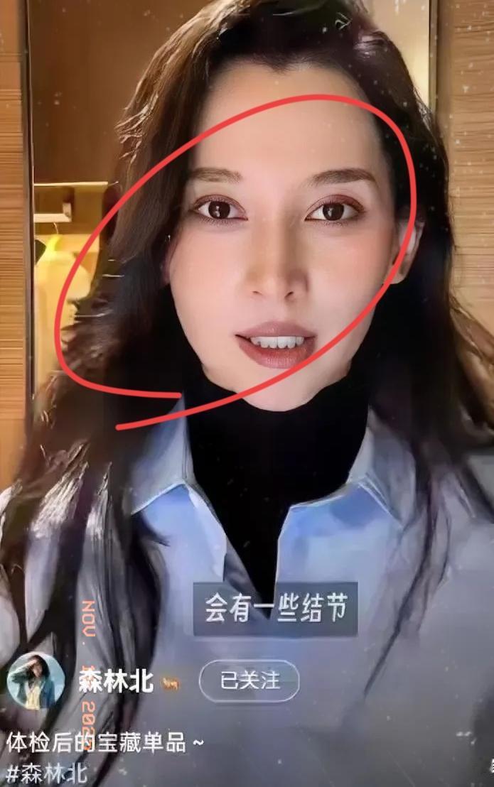 章子怡听了都得沉默，汪峰怕是要哭晕在厕所！森林北这波操作太刚了，直接晒体检报