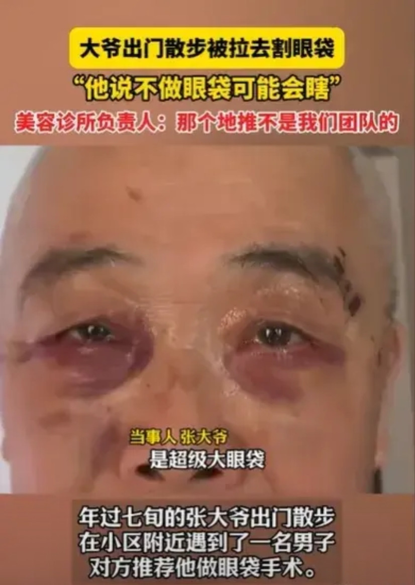 重庆，70多岁的大爷出门散步，一名男子盯上他的大眼袋了，他跟大爷说，这是超级大眼
