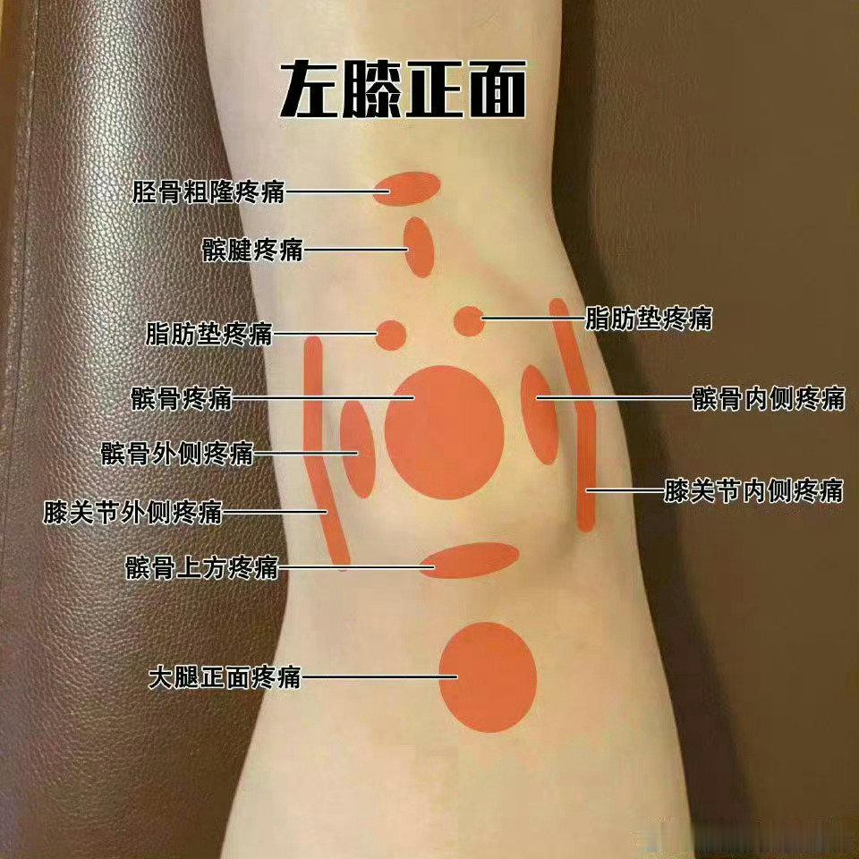 膝关节康复【膝关节损伤盘点】今天会继续发膝盖科普，先来个预告，按照“损伤结构”