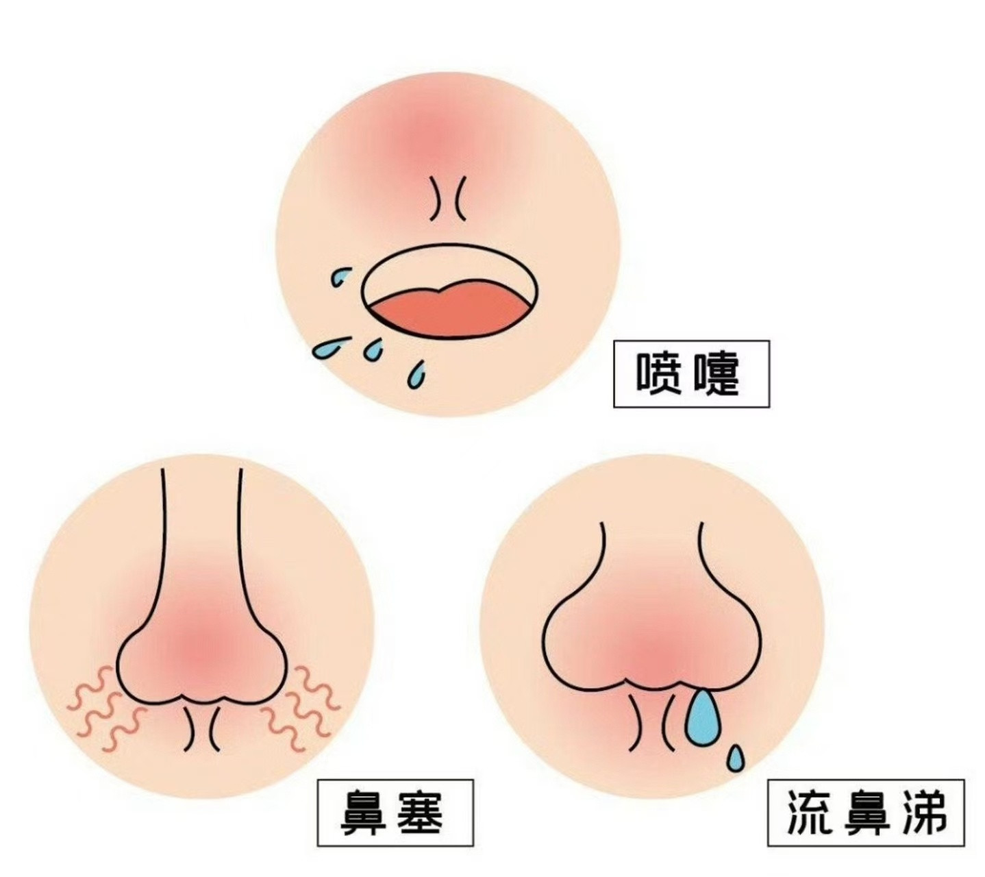 老中医：哪有什么鼻炎，都是平时缺少阳光我们总把鼻塞、喷嚏、流清涕，归罪于花粉、灰