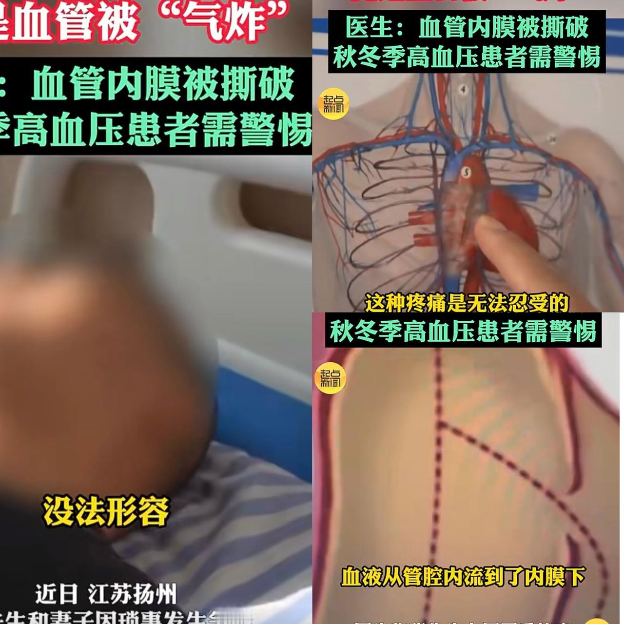 一觉醒来，“爱生气”的高血压人要注意了！近日，扬州一位张先生因为琐事与老婆吵了起