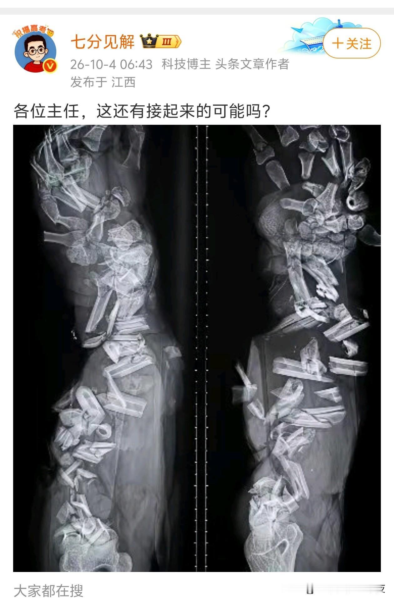 恐龙的都能接起来，这个不是事。就是其他的不能保证了。[doge]