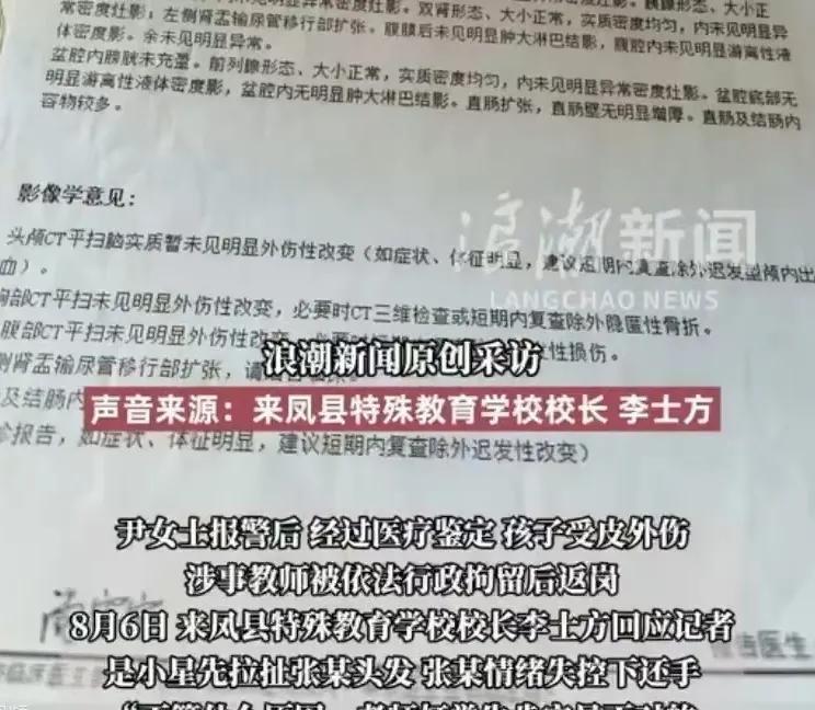 湖北恩施，女子将17岁的自闭症儿子，送往特殊学校，结果儿子被打伤，她说，她的儿子