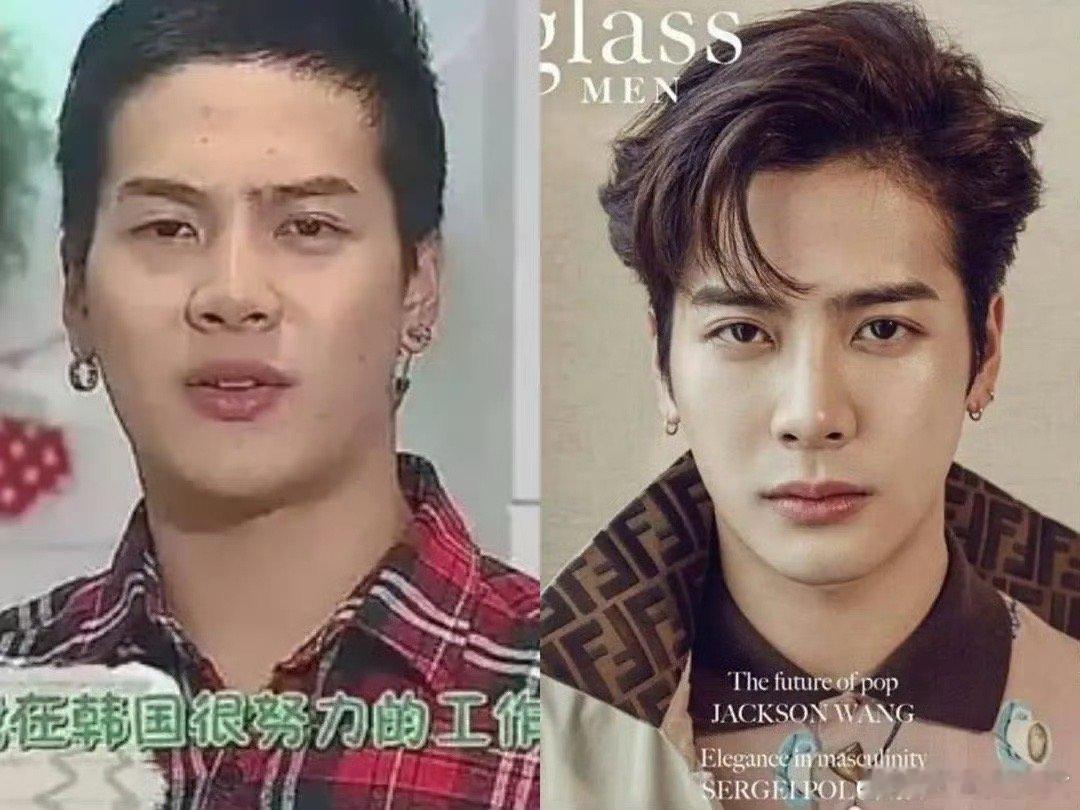 王嘉尔承认自己整容。