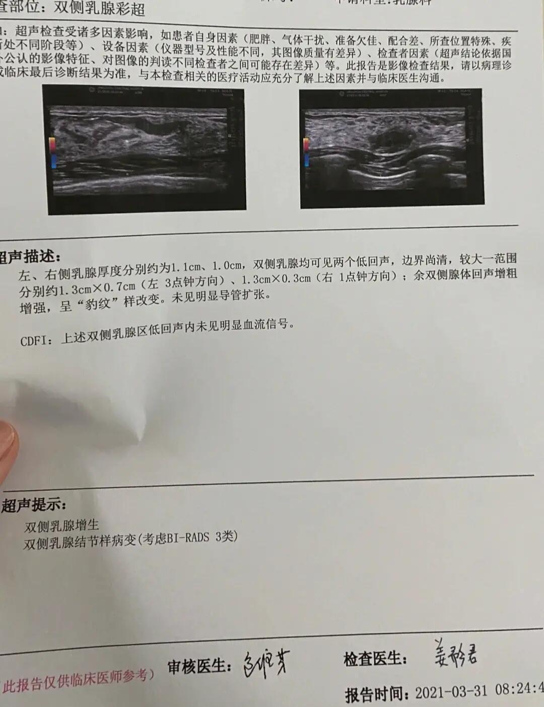 什么样的乳腺结节，最危险？医生告诉你很多女性朋友查出乳腺结节后，就特别担心，
