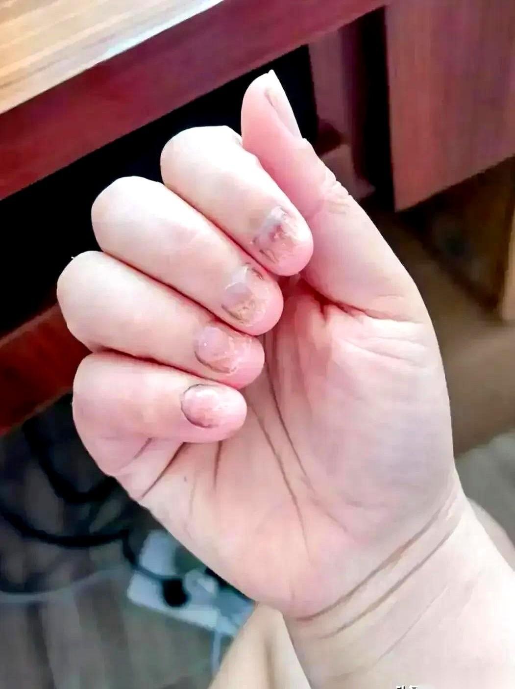 297块钱，就那么一丁点儿，5毫升。还不能走医保。为了抱我那还没出生的外孙，